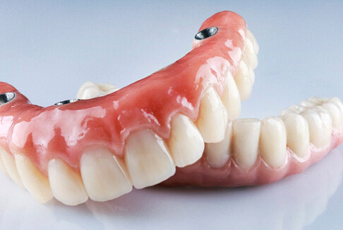 full set of implant dentures resting on reflective white surface